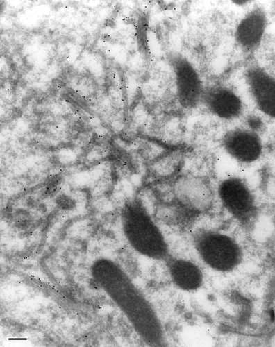 CIL:27151, Paramecium multimicronucleatum, cell by organism, eukaryotic cell, Eukaryotic Protist, Ciliated Protist