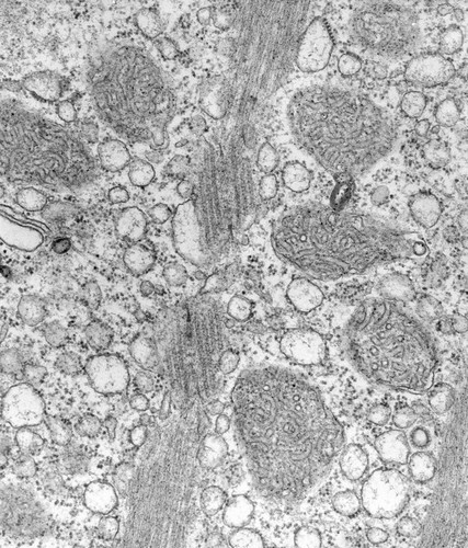 CIL:39462, Vorticella convallaria, cell by organism, eukaryotic cell, Eukaryotic Protist, Ciliated Protist