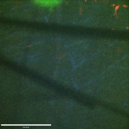 CIL:47594, Staphylococcus aureus, neutrophil, endothelial cell