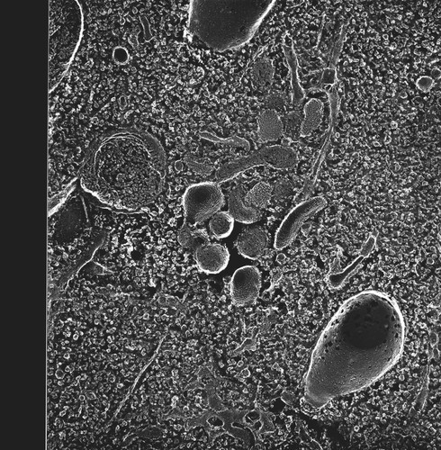 CIL:40561, Paramecium multimicronucleatum, cell by organism, eukaryotic cell, Eukaryotic Protist, Ciliated Protist