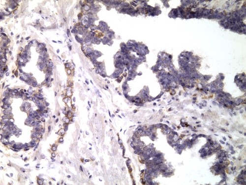 CIL:32634, Homo sapiens, endocrine-paracrine cell of prostate gland, basal cell of prostate epithelium, luminal cell of prostate epithelium, blood vessel endothelial cell, perineural cell, sheath cell, leukocyte, prostate stromal cell, smooth muscle cell of prostate