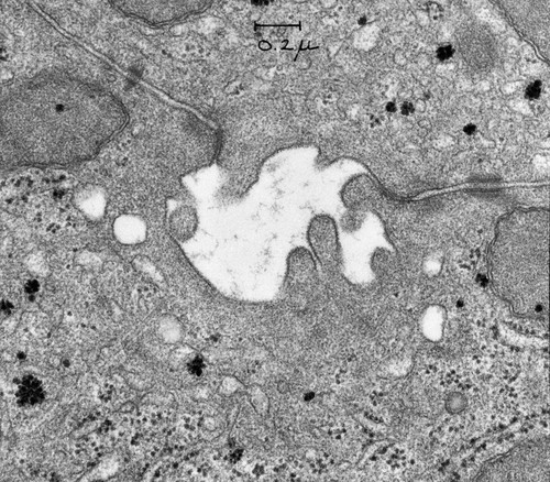 CIL:7598, Cavia porcellus, hepatocyte