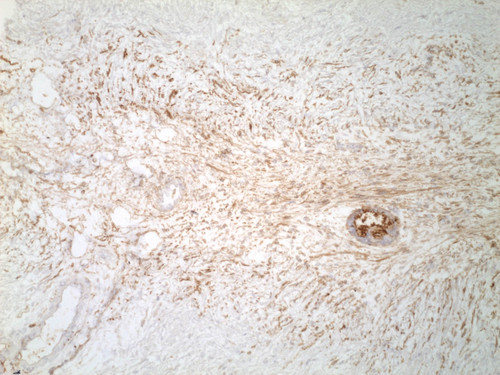 CIL:32537, Homo sapiens, endocrine-paracrine cell of prostate gland, basal cell of prostate epithelium, luminal cell of prostate epithelium, blood vessel endothelial cell, perineural cell, sheath cell, leukocyte, prostate stromal cell, smooth muscle cell of prostate