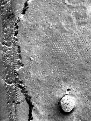 CIL:13152, Micrasterias denticulata