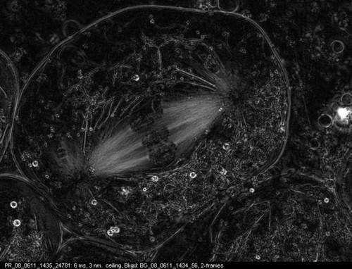 CIL:12374, Nephrotoma, Nephrotoma suturalis, primary spermatocyte