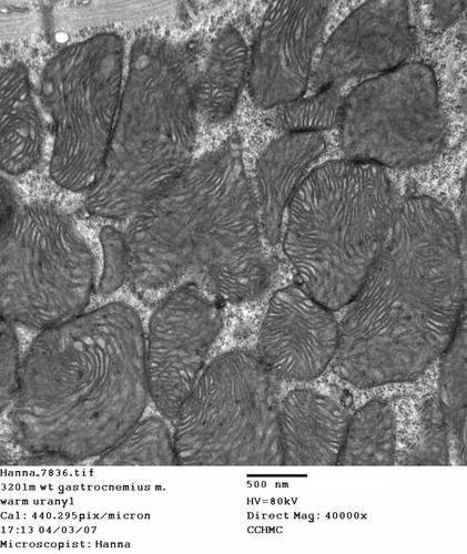 CIL:353, Mus musculus, skeletal muscle cell