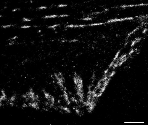 CIL:38598, Homo sapiens, fibroblast