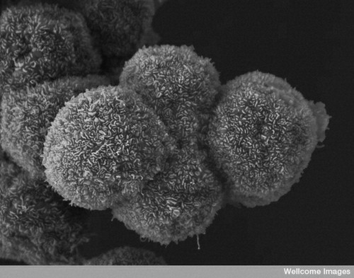 CIL:39104, pancreatic cancer cell