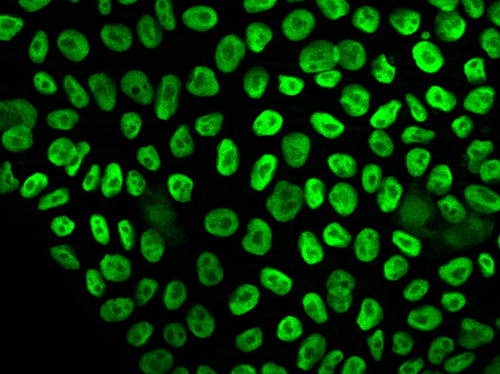 CIL: 54758, Homo sapiens, SBAD2 human iPSC line