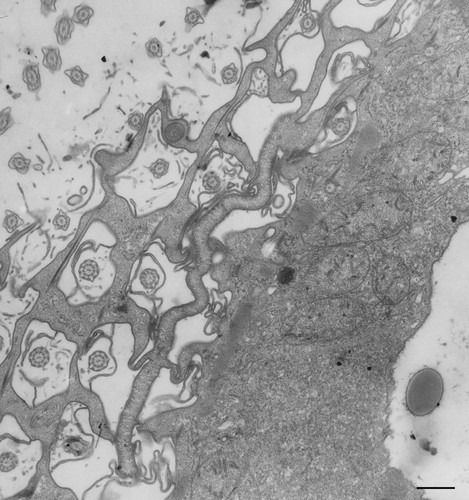 CIL:13131, Paramecium multimicronucleatum, cell by organism, eukaryotic cell, Eukaryotic Protist, Ciliated Protist