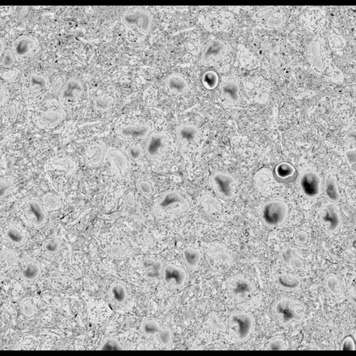 CIL:50583, MiniSOG+ ipRGC axon labeling in the suprachiasmatic nucleus