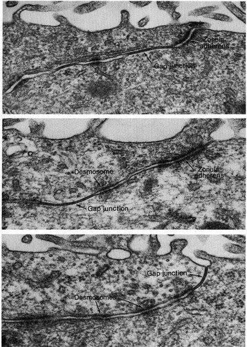 CIL:11199, Rattus, ependymal cell, epithelial cell