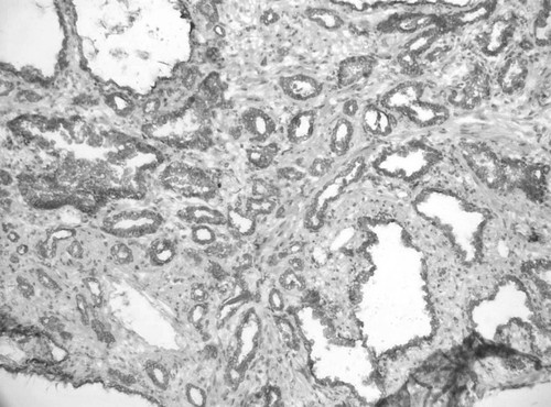 CIL:33828, Homo sapiens, endocrine-paracrine cell of prostate gland, basal cell of prostate epithelium, luminal cell of prostate epithelium, blood vessel endothelial cell, perineural cell, sheath cell, leukocyte, prostate stromal cell, smooth muscle cell of prostate