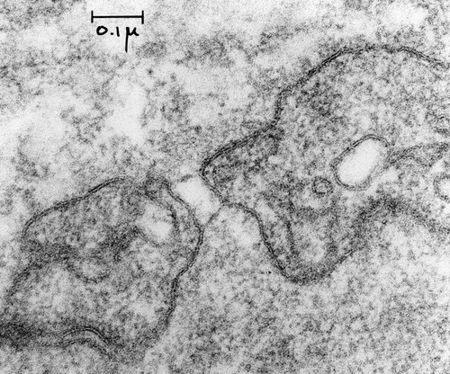 CIL:37124, Rattus, capillary endothelial cell, fenestrated cell