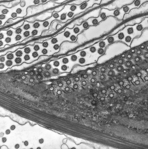 CIL:39231, uncultured scuticociliate, Conchophthirus curtus, cell by organism, eukaryotic cell, Eukaryotic Protist, Ciliated Protist