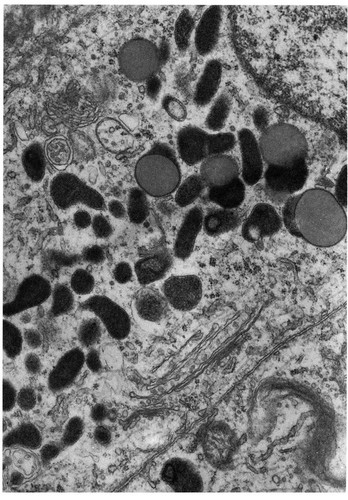 CIL:10837, Perameles nasuta, epithelial cell