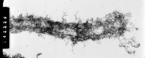 CIL:35377, Homo sapiens, cevical carcinoma