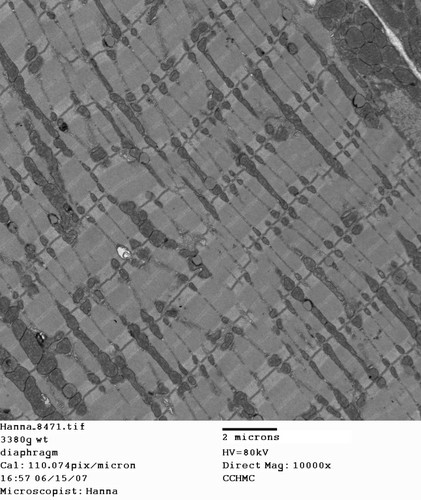 CIL:259, Mus musculus, skeletal muscle cell