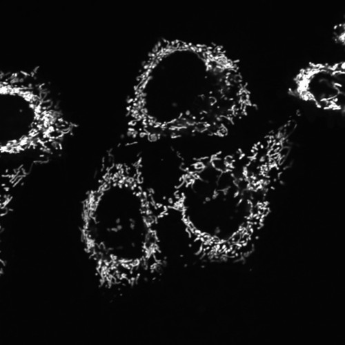 CIL:13711, Homo sapiens, epithelial cell, cervical carcinoma