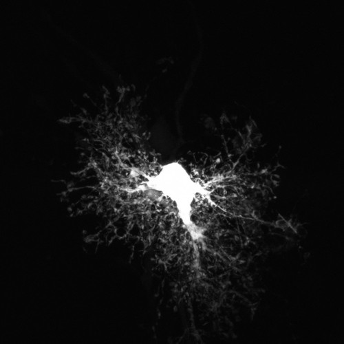 CIL:40170, Rattus norvegicus, astrocyte, astrocyte of the hippocampus