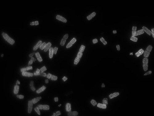 CIL: 54832, Alysiella filiformis, bacteria