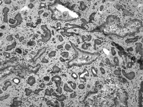 CIL:33669, Homo sapiens, endocrine-paracrine cell of prostate gland, basal cell of prostate epithelium, luminal cell of prostate epithelium, blood vessel endothelial cell, perineural cell, sheath cell, leukocyte, prostate stromal cell, smooth muscle cell of prostate