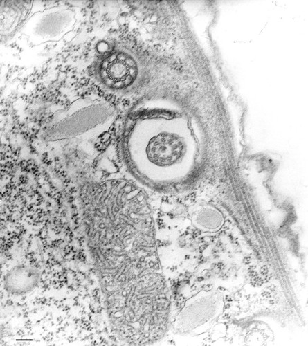 CIL:34736, Tetrahymena pyriformis, cell by organism, eukaryotic cell, Eukaryotic Protist, Ciliated Protist