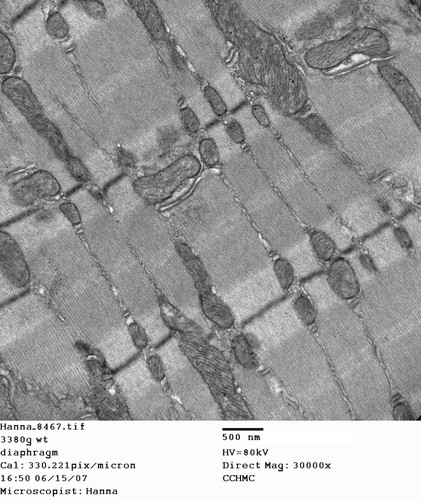 CIL:258, Mus musculus, skeletal muscle cell