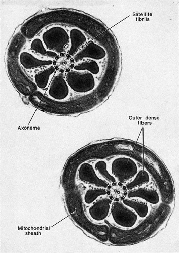 CIL:35958, Cricetulus griseus, sperm
