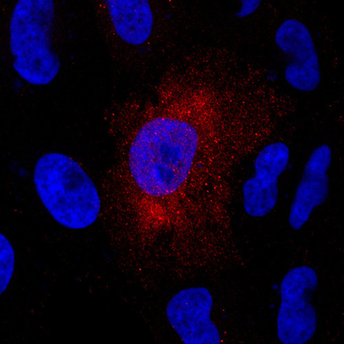 CIL: 53929, Homo sapiens, HeLa