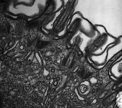 CIL:12614, Paramecium multimicronucleatum, cell by organism, eukaryotic cell, Eukaryotic Protist, Ciliated Protist