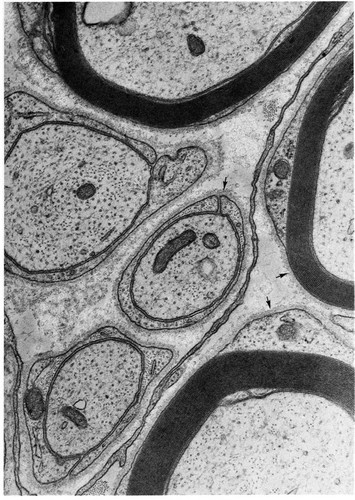 CIL:10950, Felis catus, peripheral neuron, myelinating Schwann cell