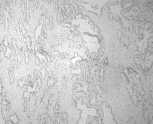 CIL:33877, Homo sapiens, endocrine-paracrine cell of prostate gland, basal cell of prostate epithelium, luminal cell of prostate epithelium, blood vessel endothelial cell, perineural cell, sheath cell, leukocyte, prostate stromal cell, smooth muscle cell of prostate