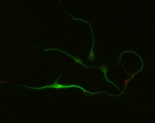 CIL:10257, Rattus, multipolar neuron