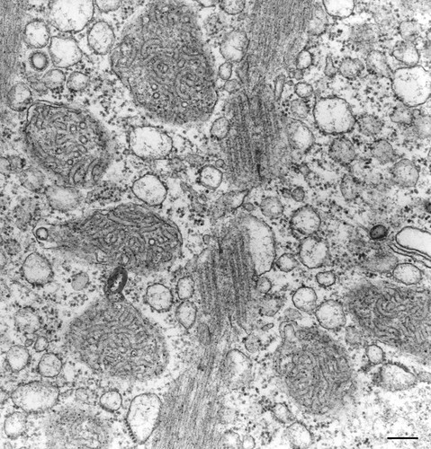 CIL:36272, Vorticella convallaria, cell by organism, eukaryotic cell, Eukaryotic Protist, Ciliated Protist