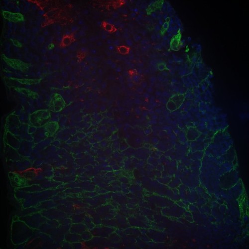 CIL: 54670, Drosophila melanogaster, astrocytes (red)