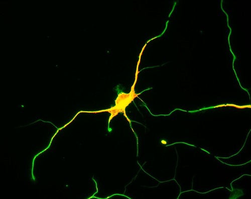 CIL:8262, Rattus, multipolar neuron