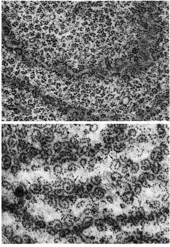 CIL:10772, Homo sapiens, motor neuron, adrenocorticotropic hormone secreting cell