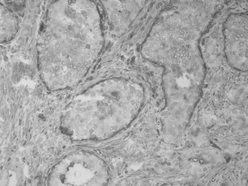 CIL:33611, Homo sapiens, endocrine-paracrine cell of prostate gland, basal cell of prostate epithelium, luminal cell of prostate epithelium, blood vessel endothelial cell, perineural cell, sheath cell, leukocyte, prostate stromal cell, smooth muscle cell of prostate