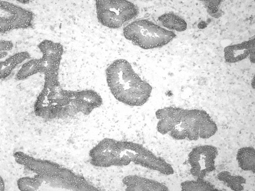 CIL:33542, Homo sapiens, endocrine-paracrine cell of prostate gland, basal cell of prostate epithelium, luminal cell of prostate epithelium, blood vessel endothelial cell, perineural cell, sheath cell, leukocyte, prostate stromal cell, smooth muscle cell of prostate