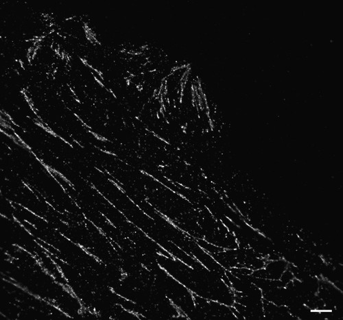 CIL:38600, Homo sapiens, fibroblast