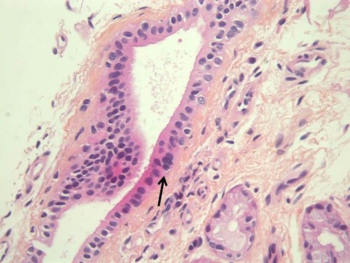 CIL: 53282, Homo sapiens, basal cell