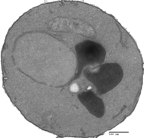 CIL:39691, Saccharomyces cerevisiae, BY4716