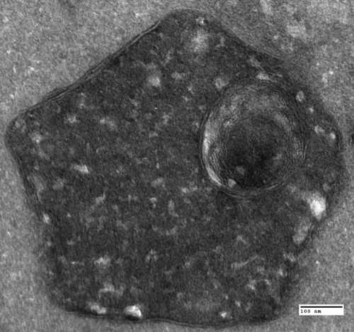 CIL:40448, Saccharomyces cerevisiae, vma9 mutant