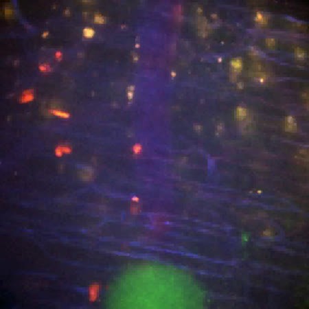 CIL:47374, Staphylococcus aureus, neutrophil, endothelial cell