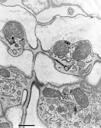 CIL:9719, Coleps hirtus, eukaryotic cell, Eukaryotic Protist, Ciliated Protist