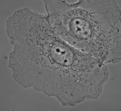 CIL:159, Potorous tridactylus, epithelial cell