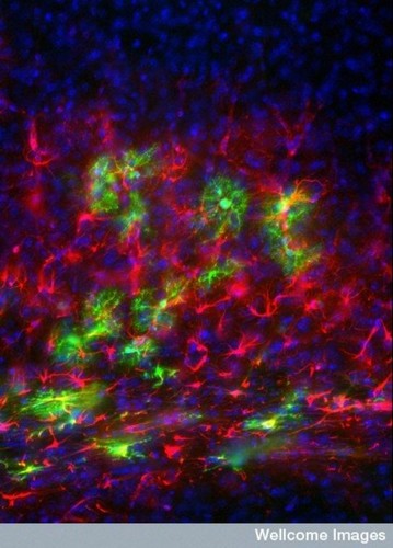 CIL:38902, Mus musculus, neuronal stem cell, oligodendrocyte, astrocyte