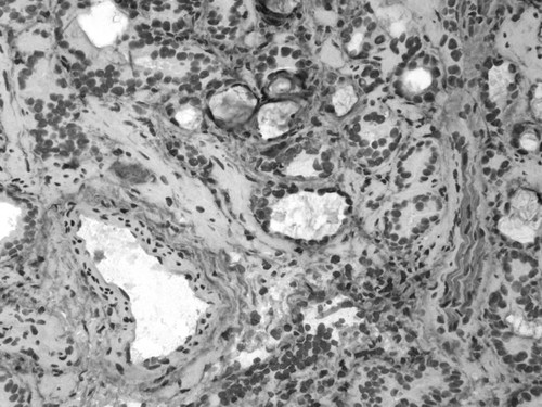 CIL:34115, Homo sapiens, endocrine-paracrine cell of prostate gland, basal cell of prostate epithelium, luminal cell of prostate epithelium, blood vessel endothelial cell, perineural cell, sheath cell, leukocyte, prostate stromal cell, smooth muscle cell of prostate