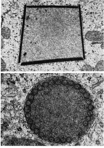 CIL:11493, Rattus, renal principal cell